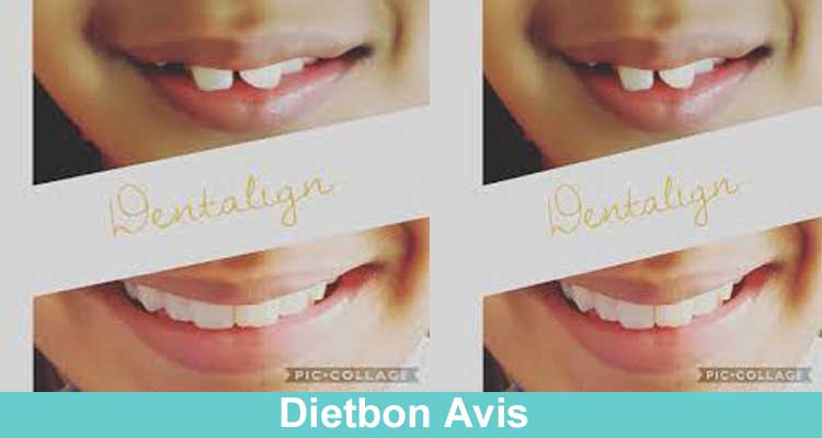 Dentalign Online Website Avis
