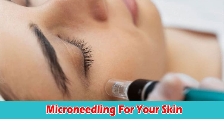 Top 6 Surprising Benefits Of Microneedling For Your Skin